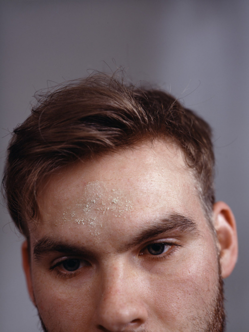 A closeup image of a male face, only from the nose to the top of the head. On the forehead is a cross of ashes.